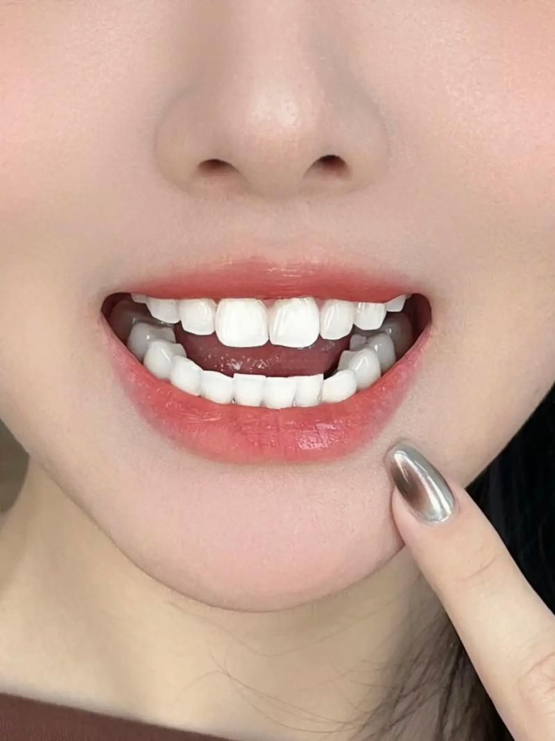 想拥有洁白牙齿？试试Beyond冷光美白