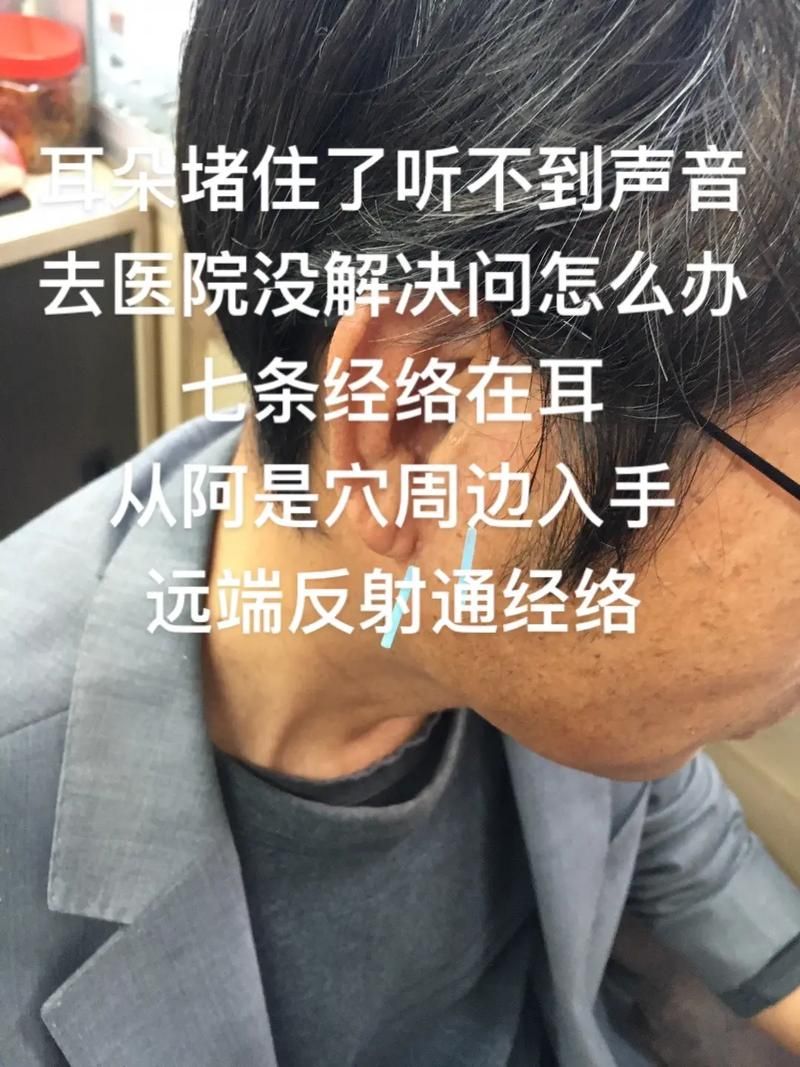 突然听不到声音是怎么回事？别慌张先了解这些情况。