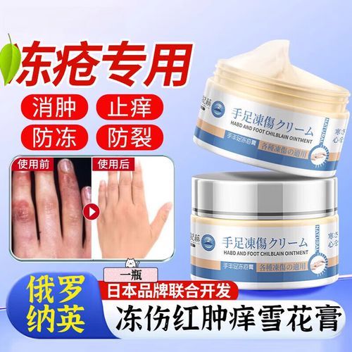 俄罗那英膏副作用有哪些 使用前必看