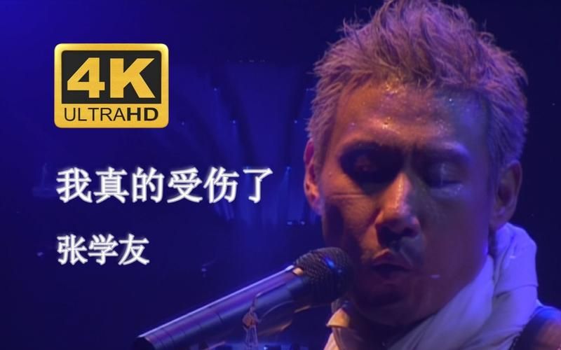 张学友左手受伤真相曝光 原来是因为这个原因