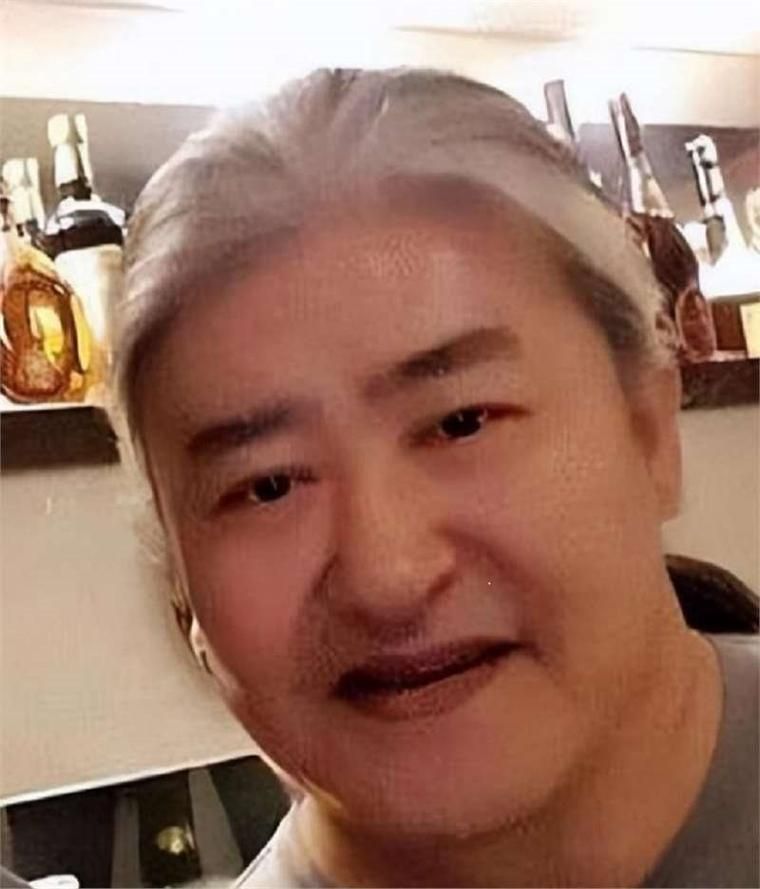 刘欢换股骨头35万