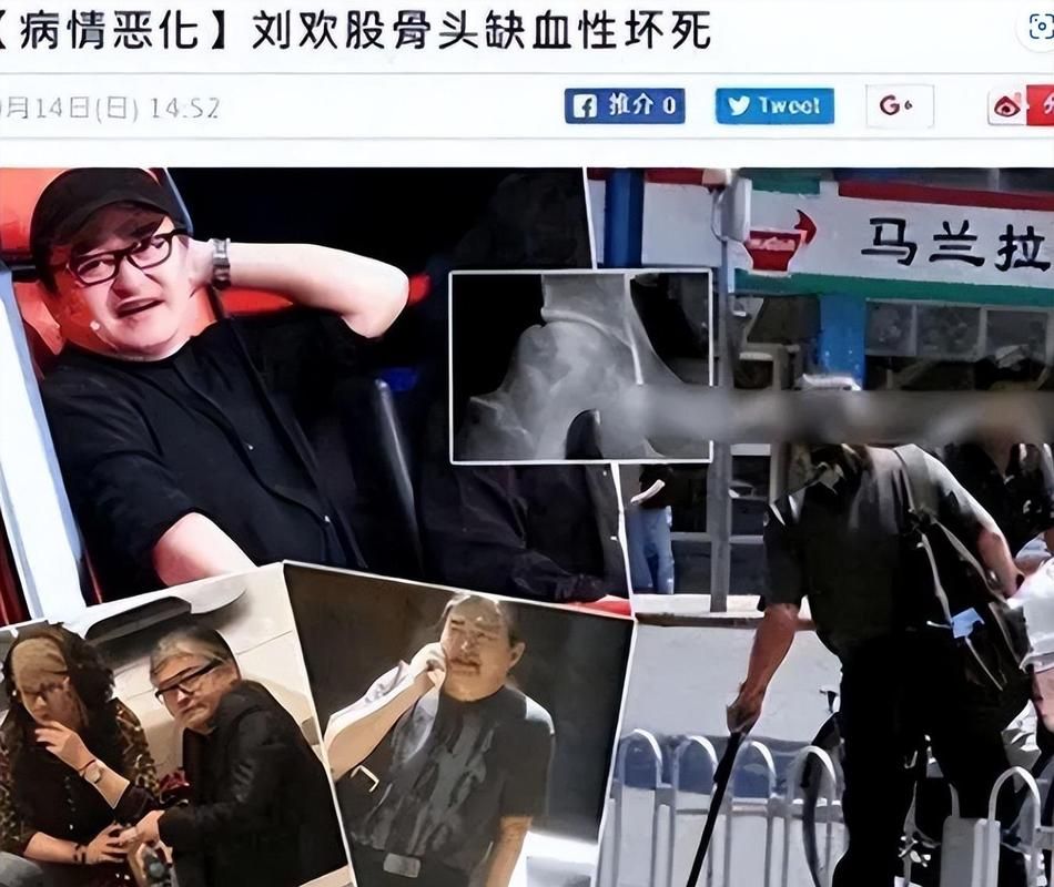 刘欢生了什么病