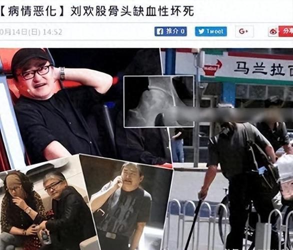 刘欢的病